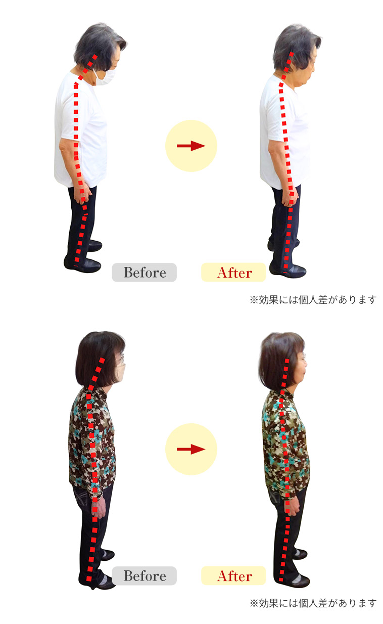 ビフォーアフター