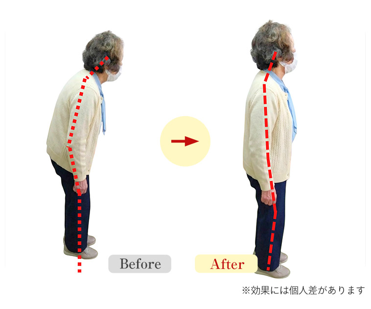 ビフォーアフター