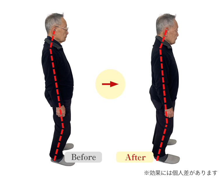 ビフォーアフター